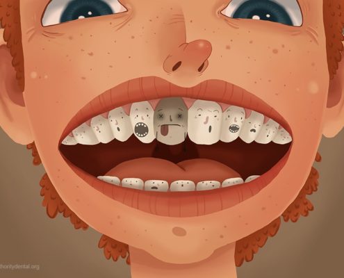 cavity