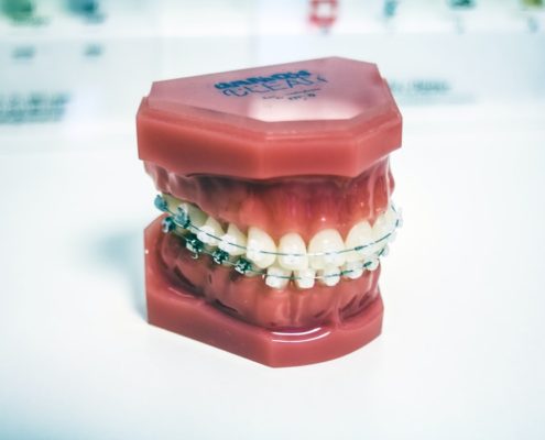 braces care