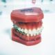 braces care
