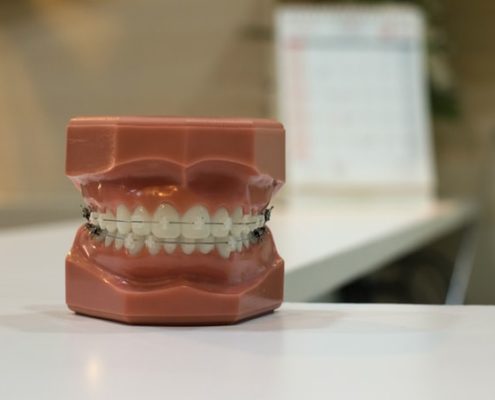 Gum Disease