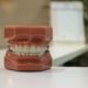 Gum Disease